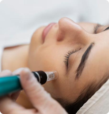 Microneedling (Face & Scalp)